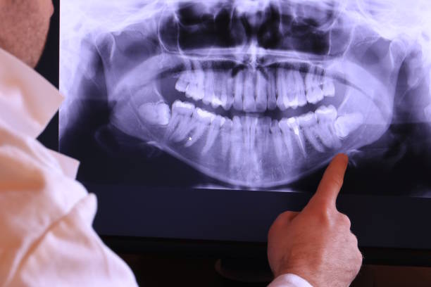 Best Emergency Dental Care for Broken or Chipped Teeth in Dellwood, MN