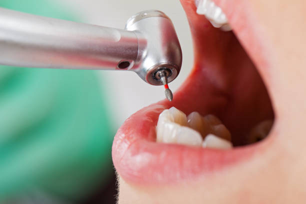Best Emergency Denture Repair in Dellwood, MN